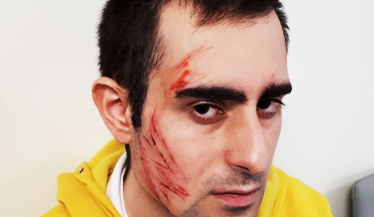 Pontevedrés ferido polo ataque dun dóberman