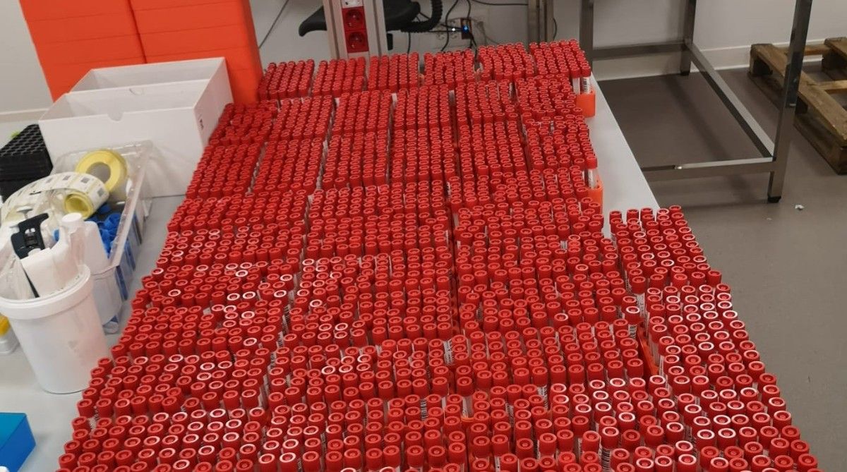 Tubos con las muestras de saliva
