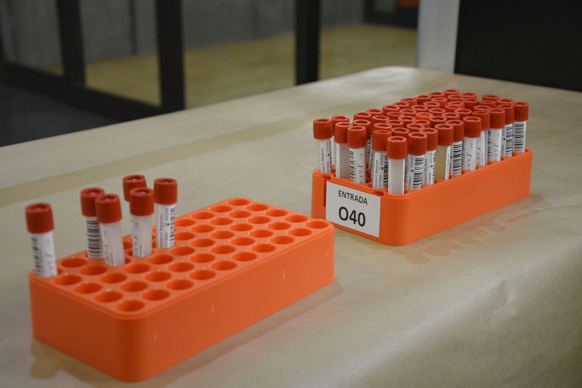 Tubos con las muestras para hacer la prueba PCR