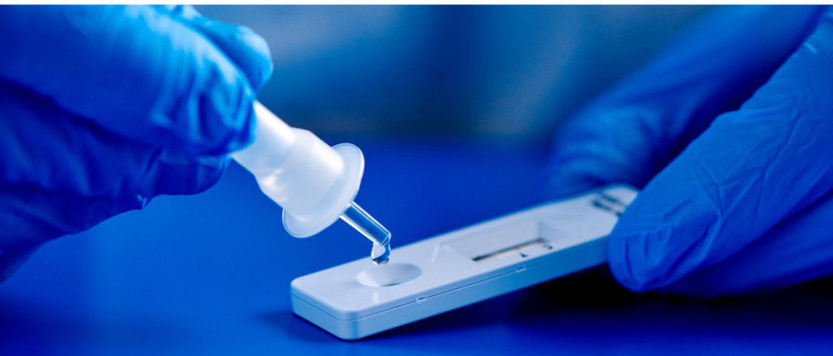 Programa de antíxenos nas farmacias de Pontevedra