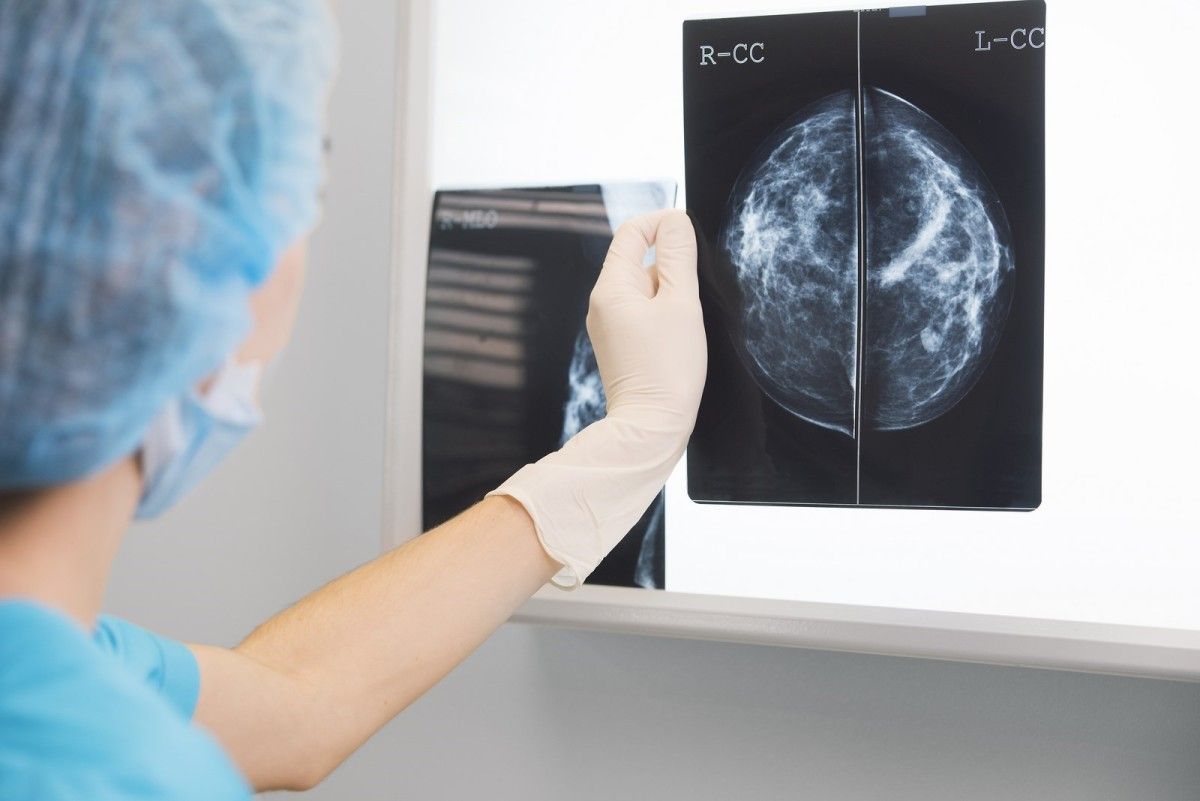 Exploración de cancro de mama no programa de Detección Precoz da Consellería de Sanidade