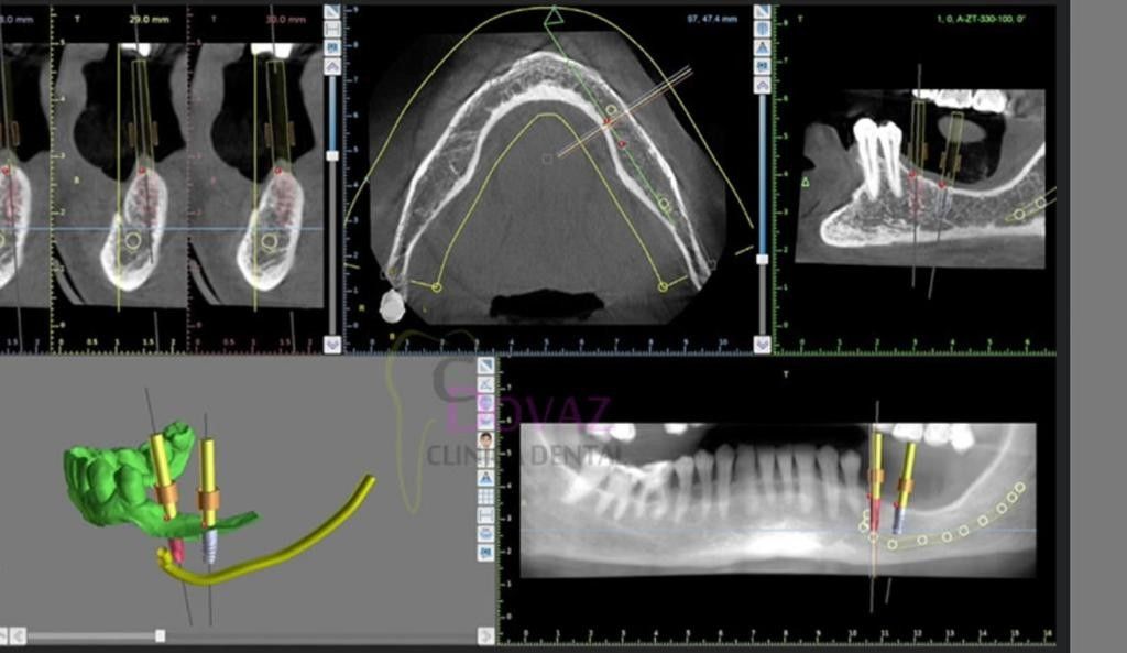 Odontoloxía dixital