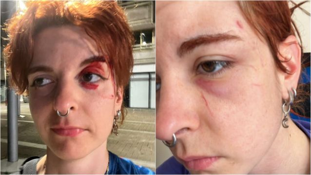 Chuvia, la joven que sufrió una agresión homófoba en Pontevedra Chuvia, la joven que sufrió una agresión homófoba en Pontevedra