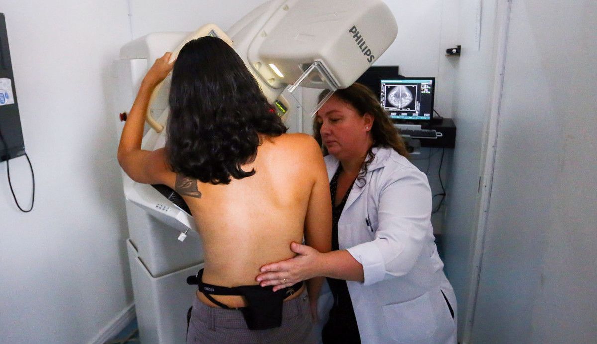 Mamografía